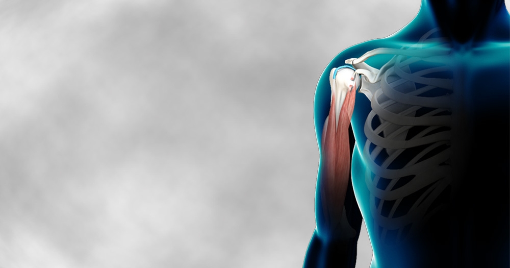 5 Common Signs of a Bicep Tendon Injury