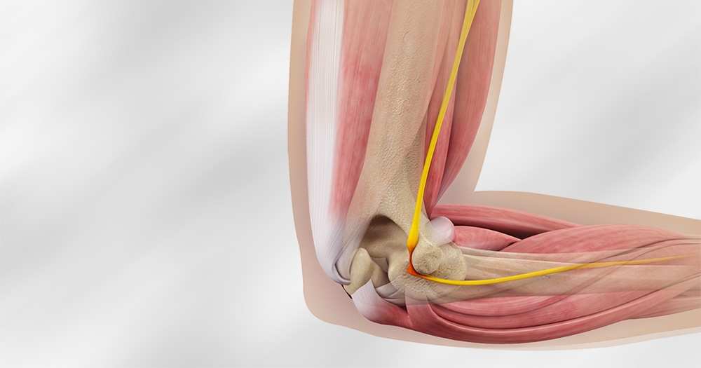 5 Common Signs of Cubital Tunnel Syndrome