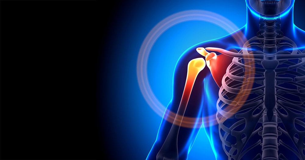 Best Options for Relieving Arthritis Pain in the Shoulder